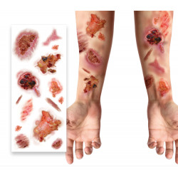 TATOUAGE PLAIES INFECTEES...