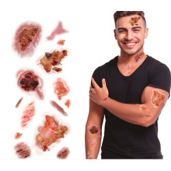 TATOUAGE PLAIES INFECTEES...